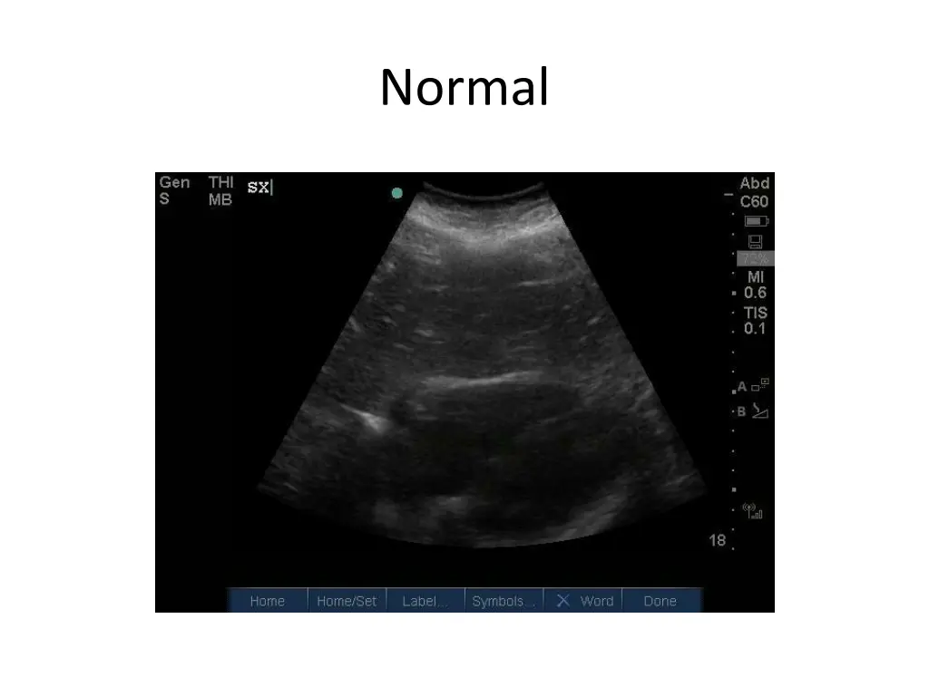 normal 7