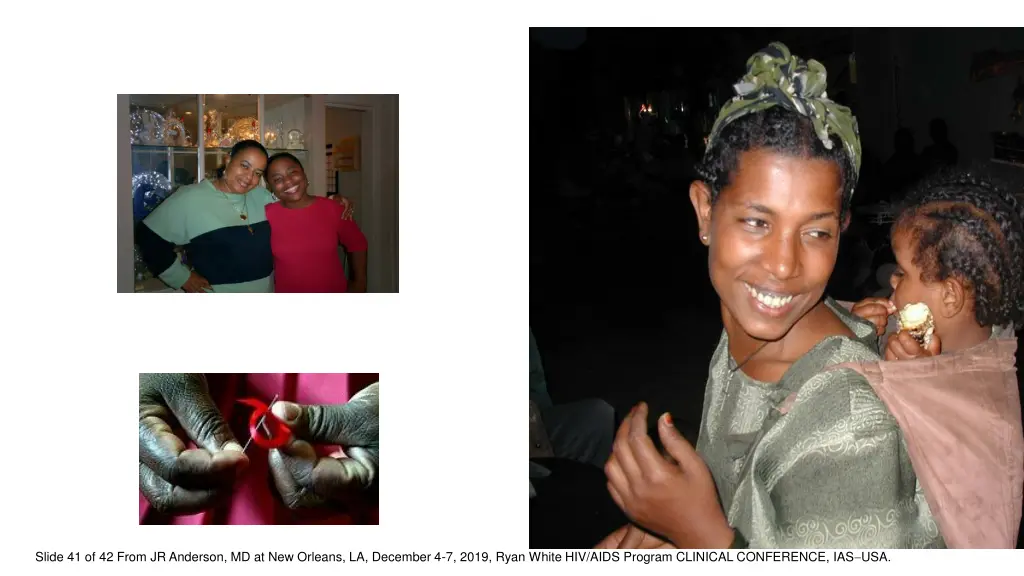 slide 41 of 42 from jr anderson md at new orleans
