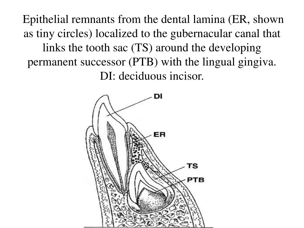 epithelial remnants from the dental lamina