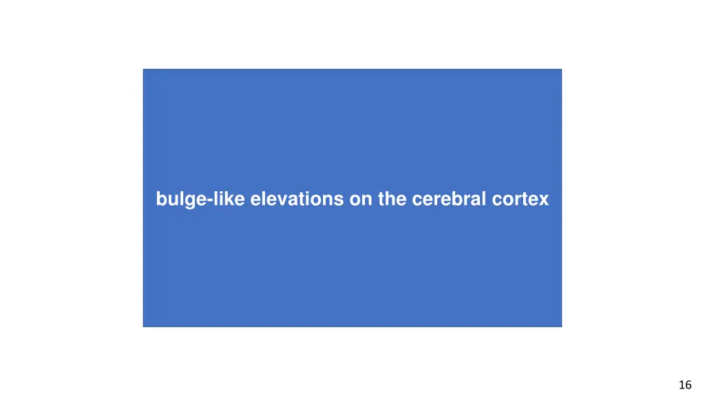 a neuron that responds to lines of specific