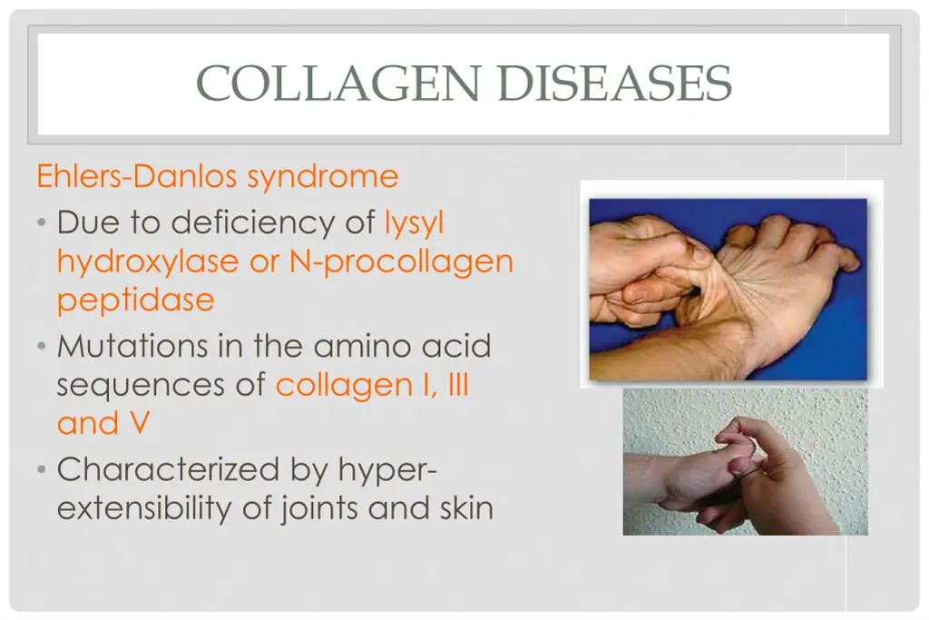 collagen diseases 1