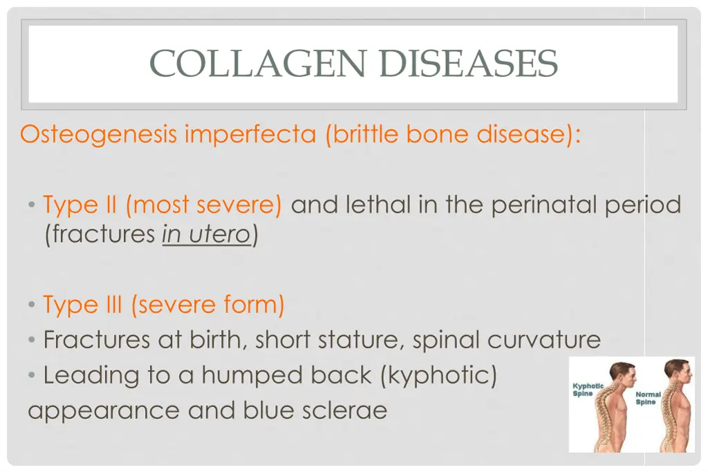 collagen diseases 3