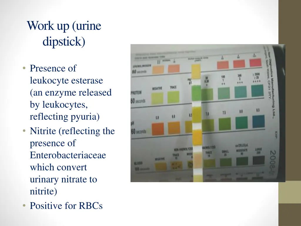 work up urine dipstick
