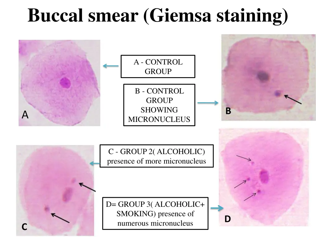 buccal smear giemsa staining