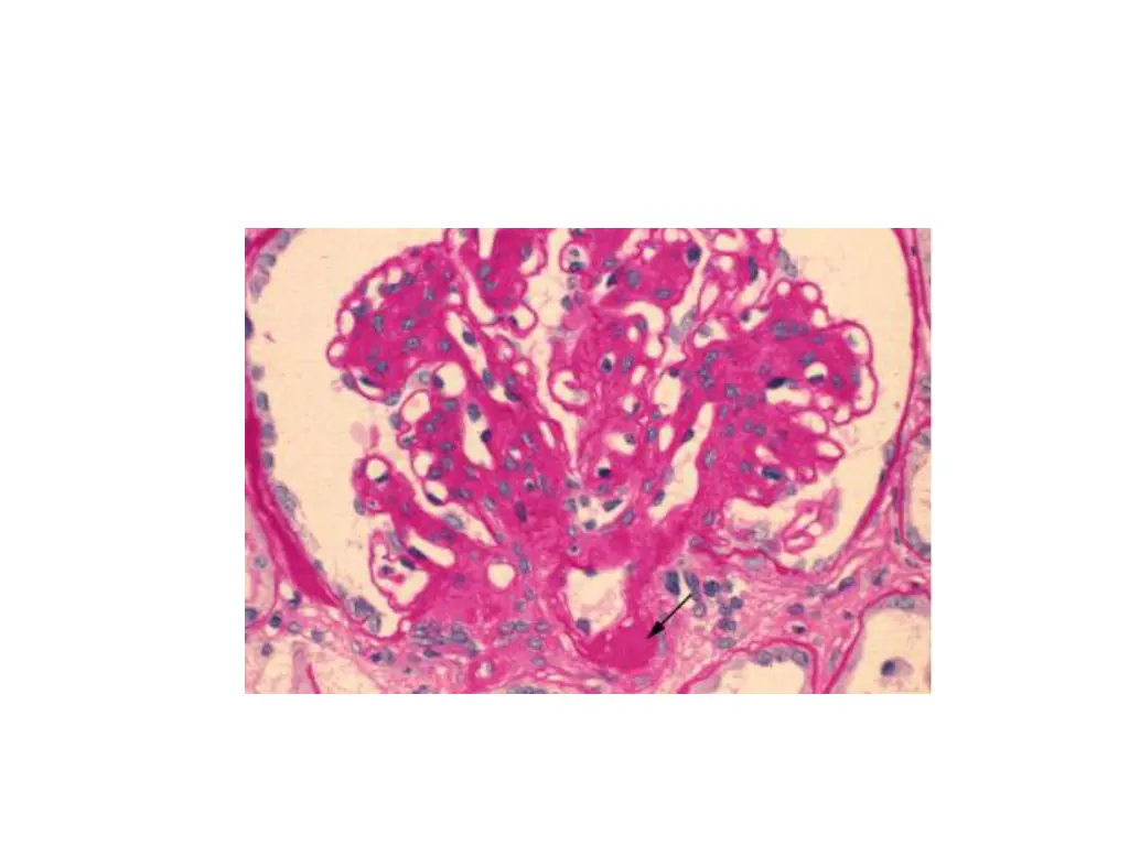 slide17