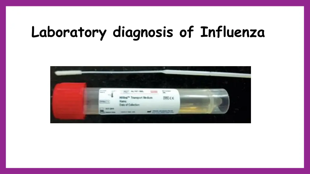 laboratory diagnosis of influenza 1