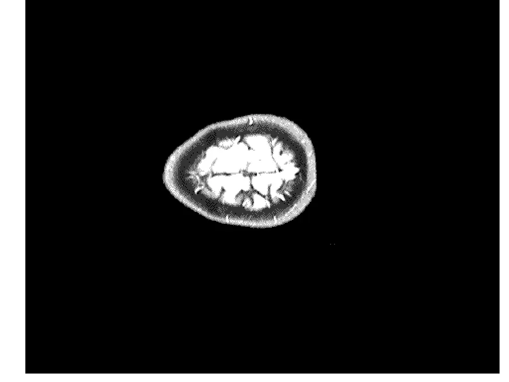 slide11
