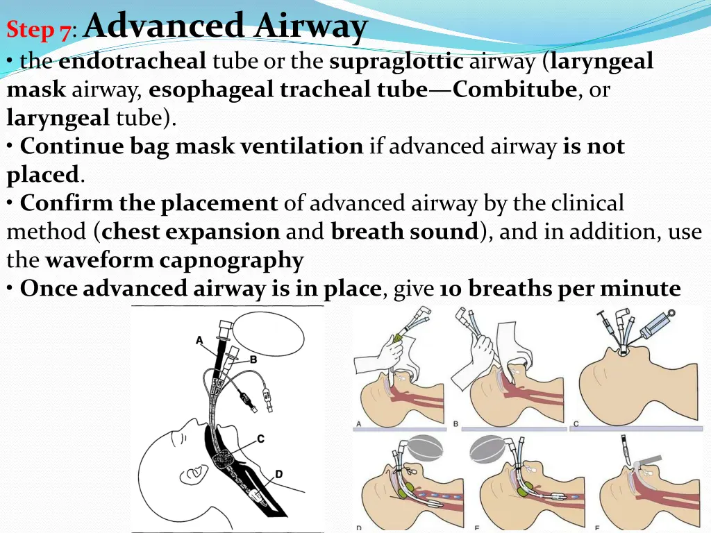 step 7 advanced airway the endotracheal tube