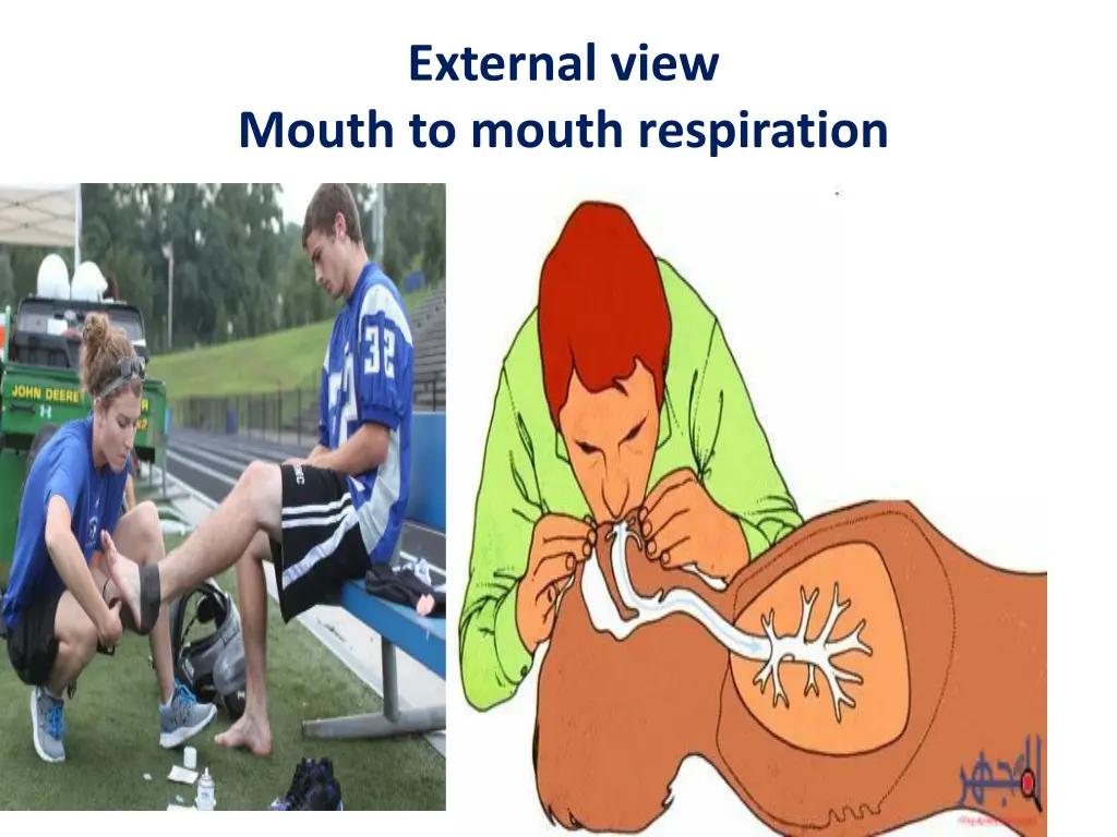 external view mouth to mouth respiration