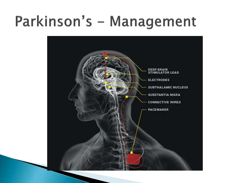 slide29
