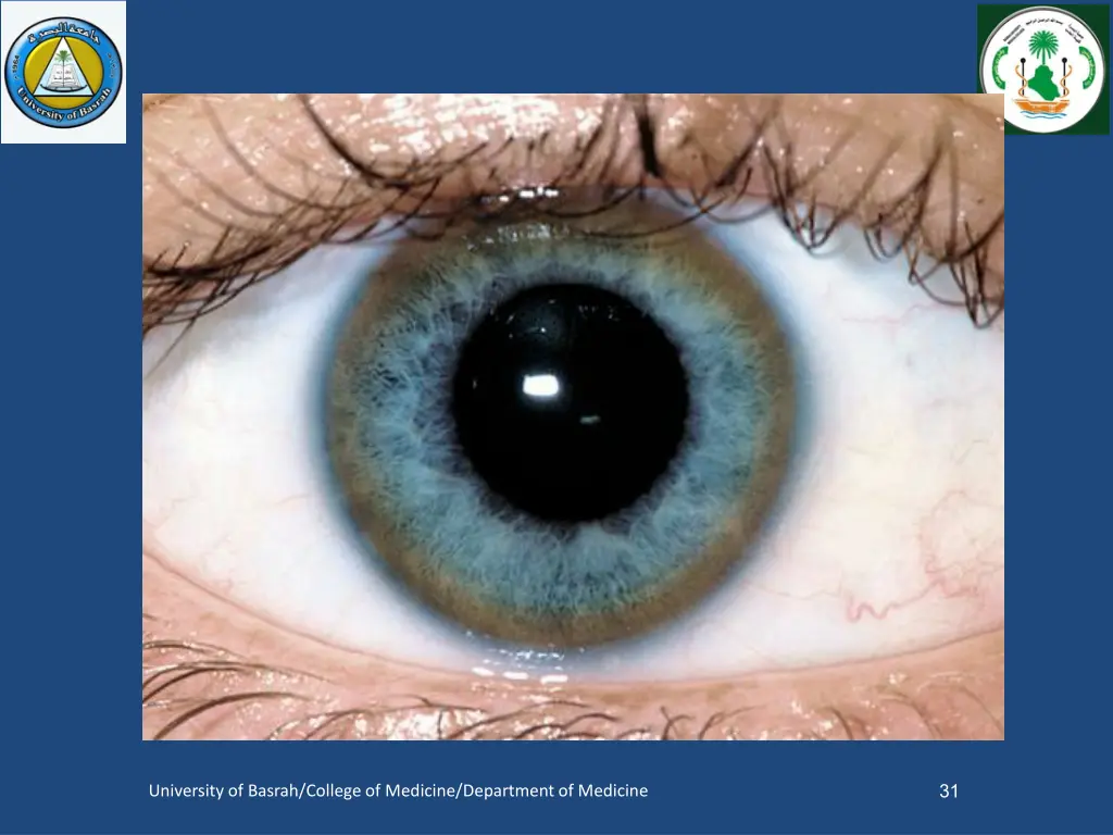 slide31