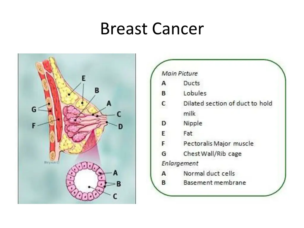 breast cancer 1