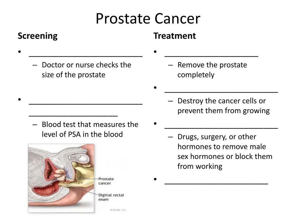 prostate cancer 1