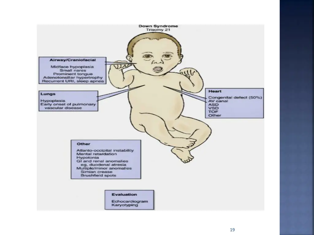 slide19
