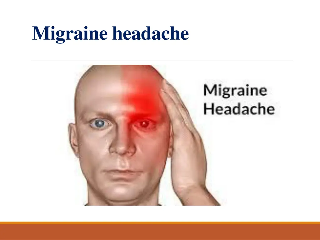 migraine headache