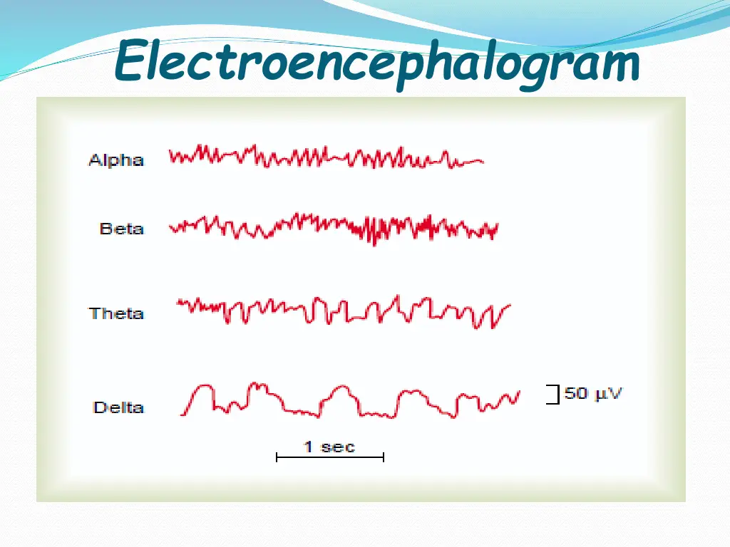 electroencephalogram