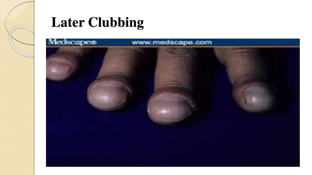 later clubbing