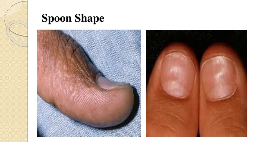 spoon shape