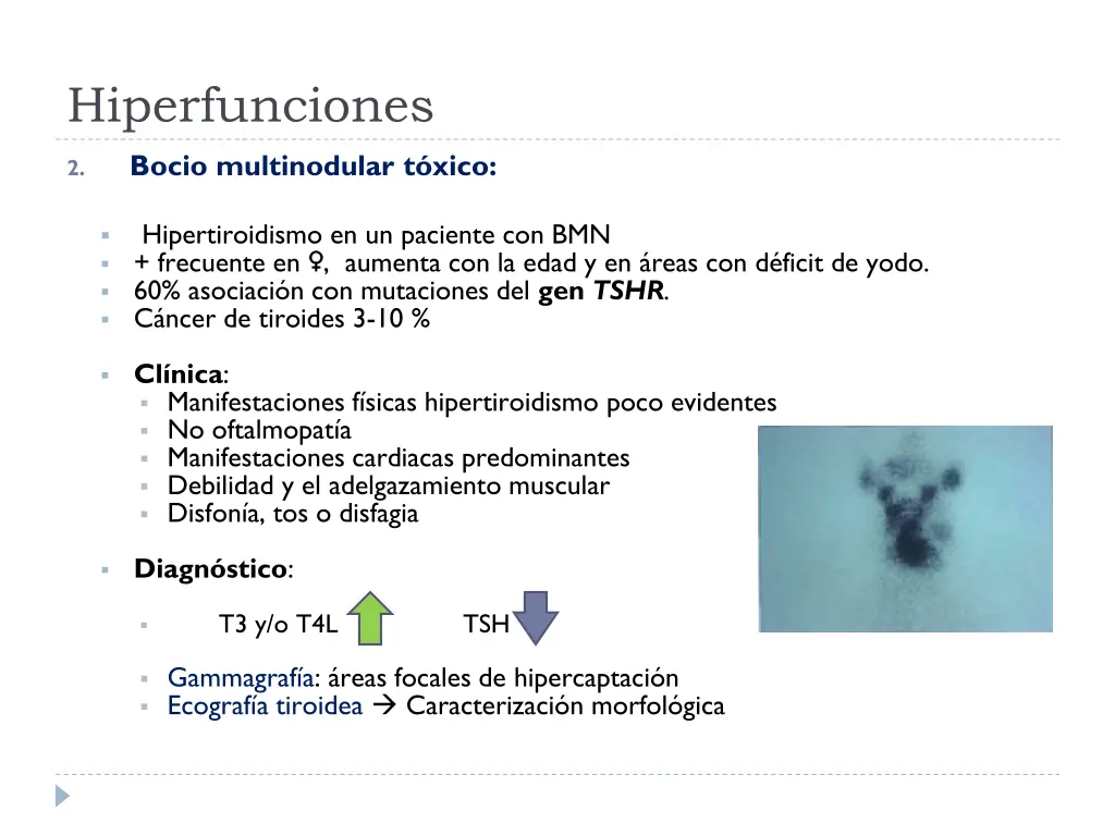 hiperfunciones 1