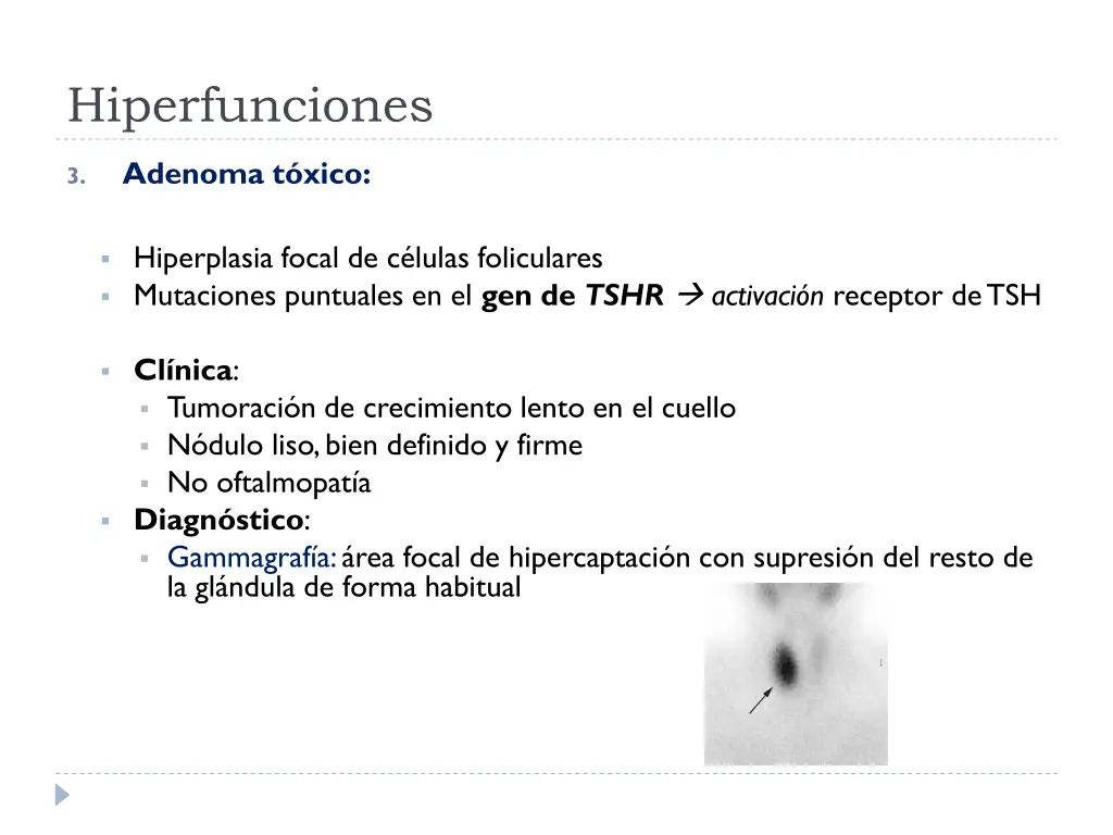 hiperfunciones 2