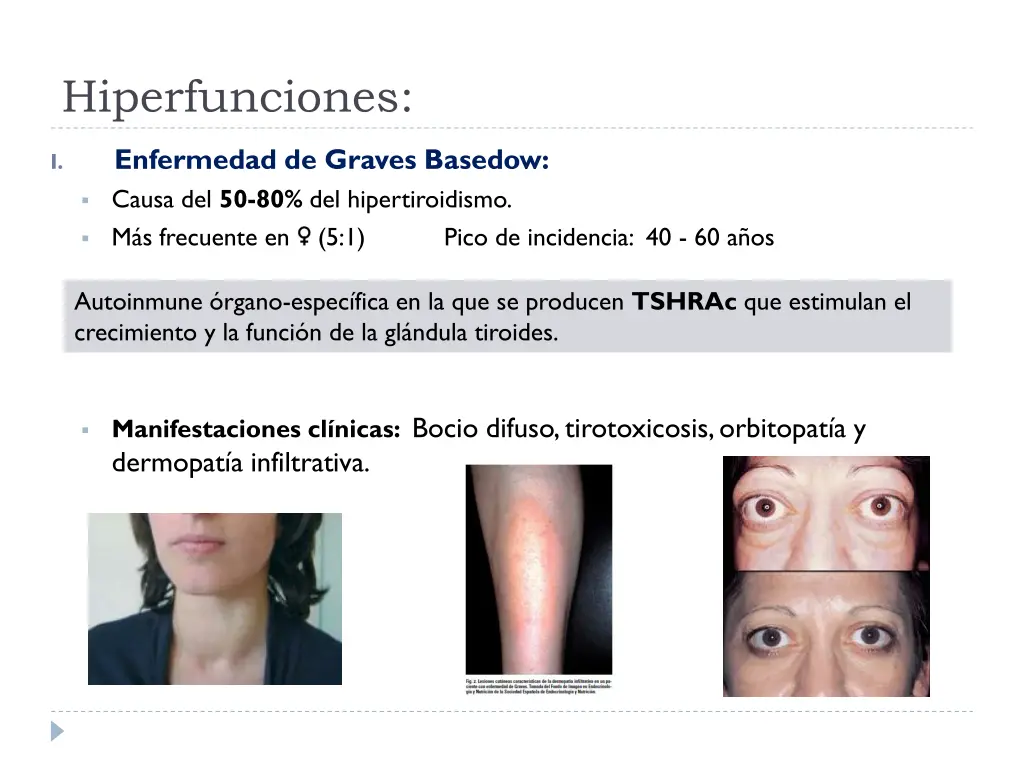 hiperfunciones