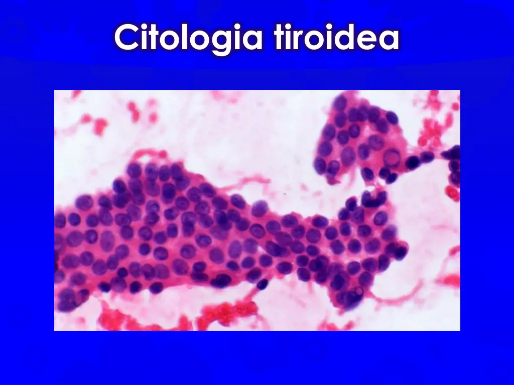 citologia tiroidea