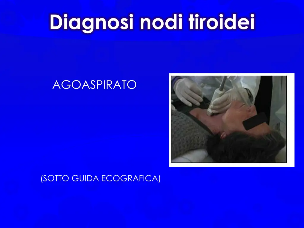 diagnosi nodi tiroidei 1