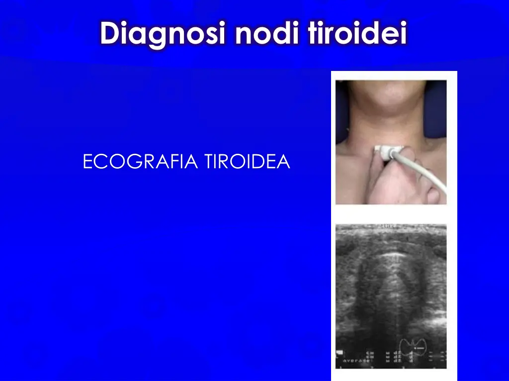 diagnosi nodi tiroidei