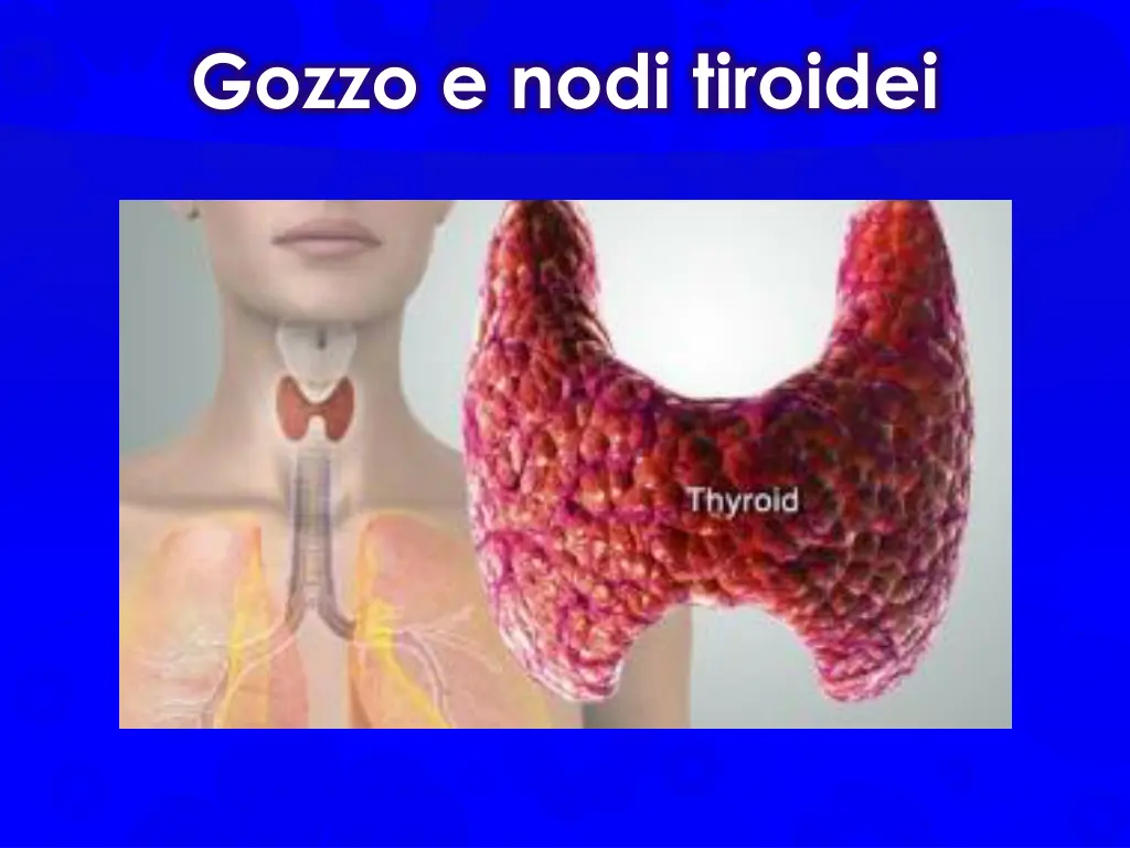 gozzo e nodi tiroidei 1
