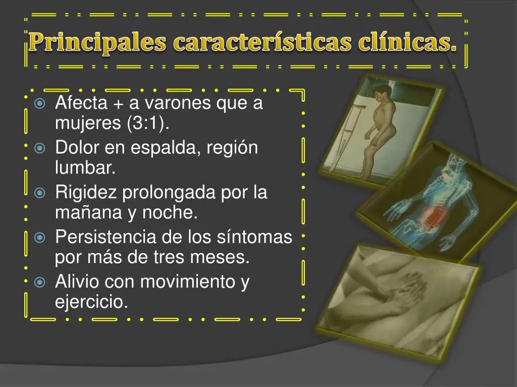 afecta a varones que a mujeres 3 1 dolor