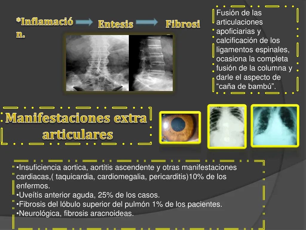 fusi n de las articulaciones apoficiarias