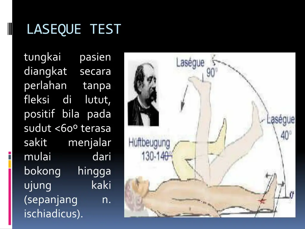 laseque test