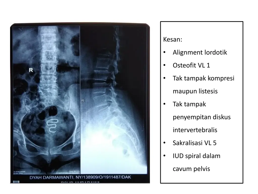 kesan