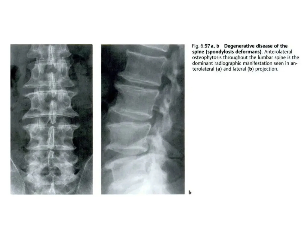 slide19