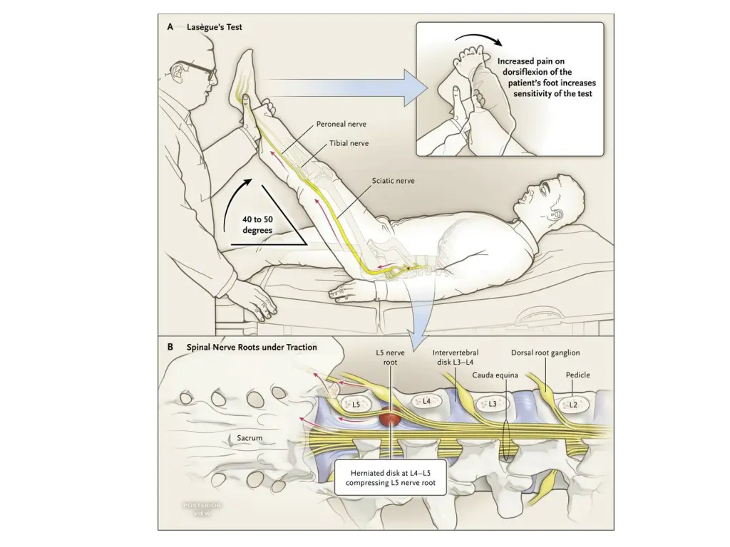 slide35