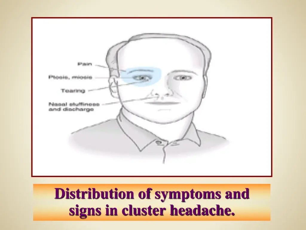distribution of symptoms and signs in cluster
