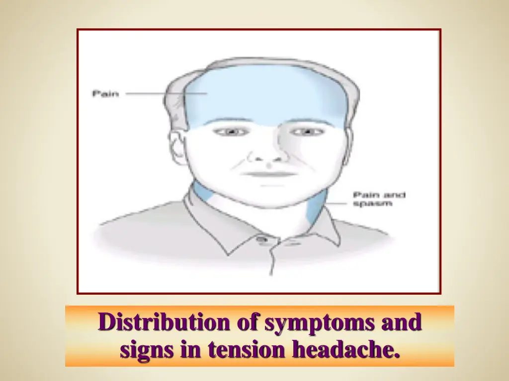 distribution of symptoms and signs in tension