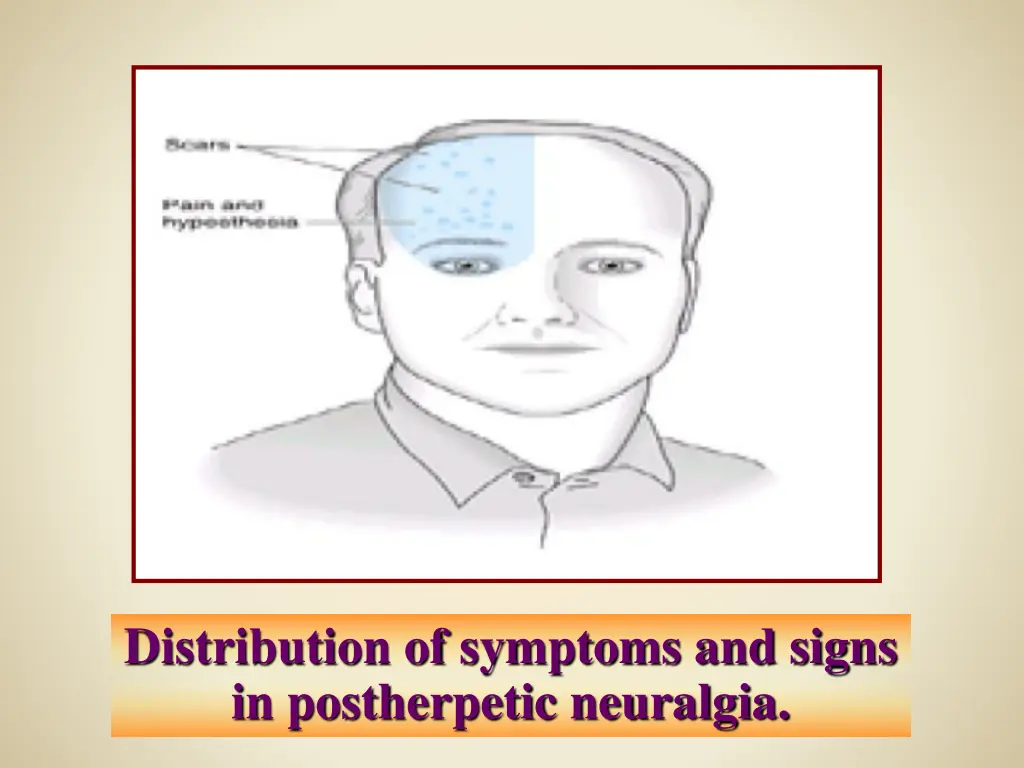 distribution of symptoms and signs