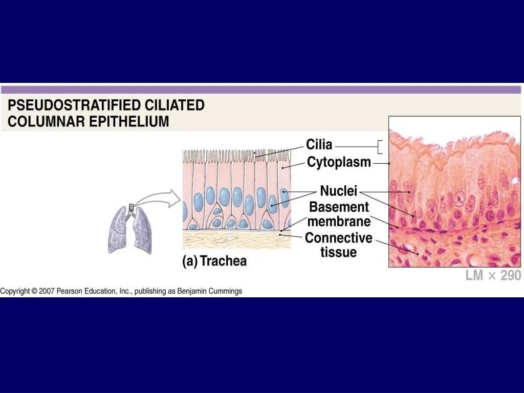 slide14