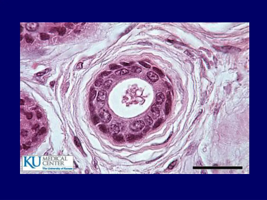 slide18