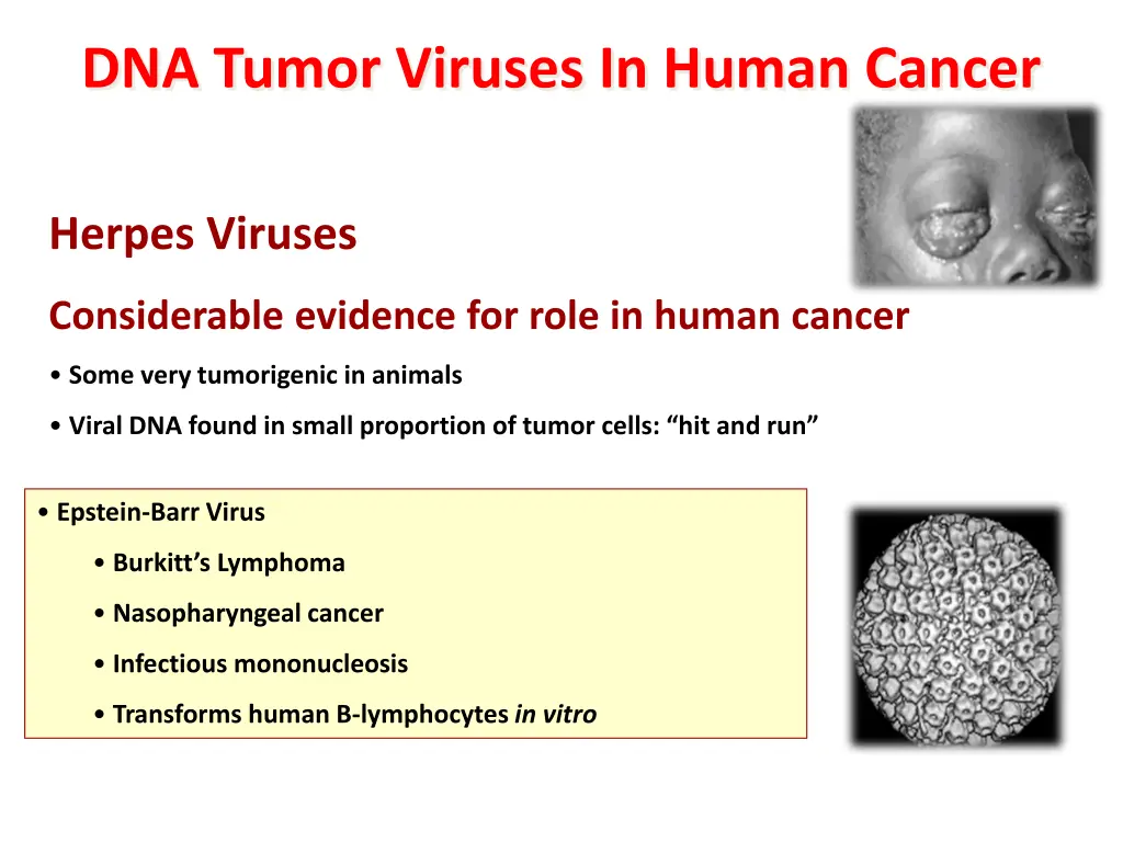 dna tumor viruses in human cancer 1