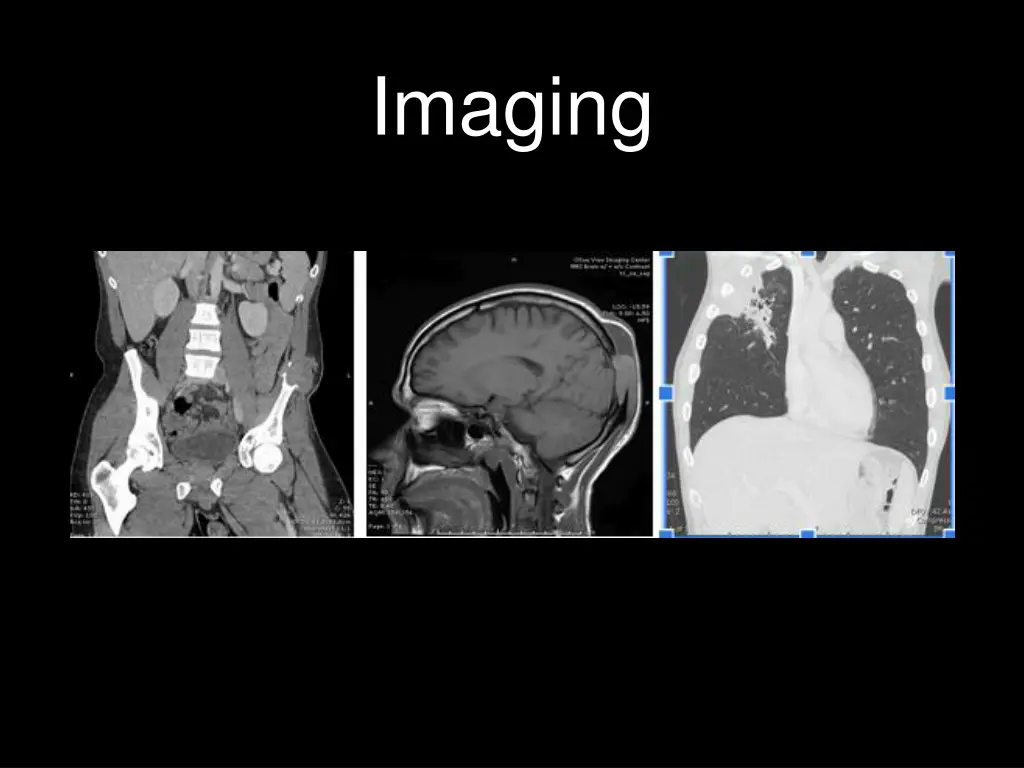 imaging