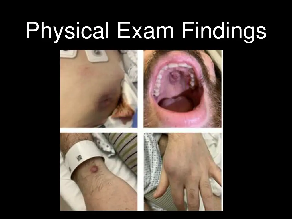 physical exam findings
