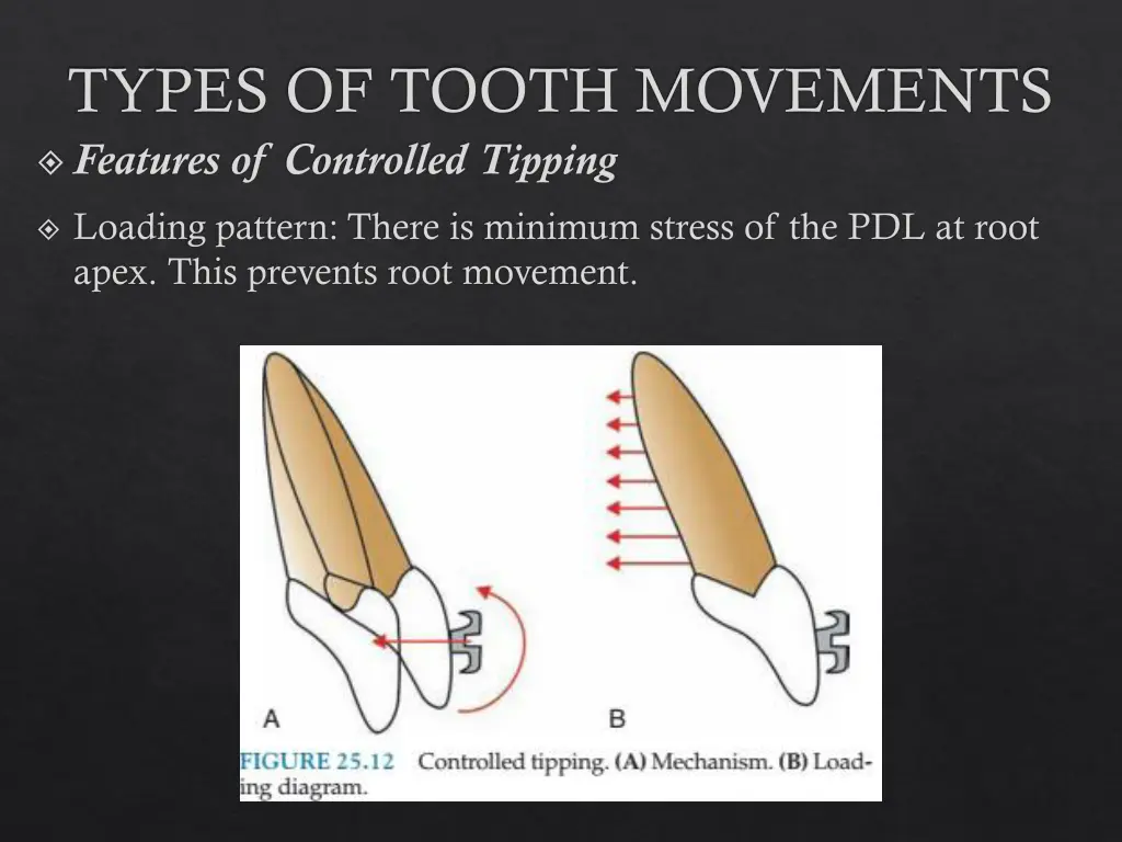 types of tooth movements features of controlled
