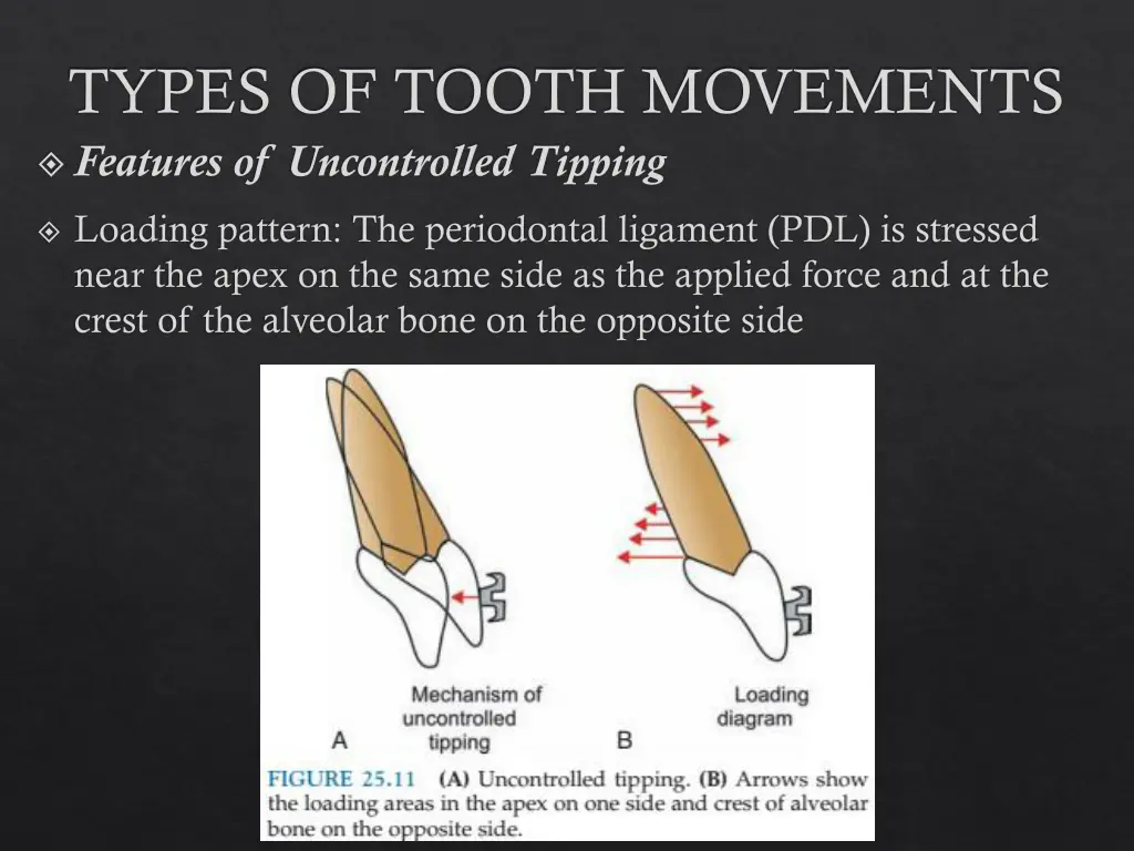 types of tooth movements features of uncontrolled