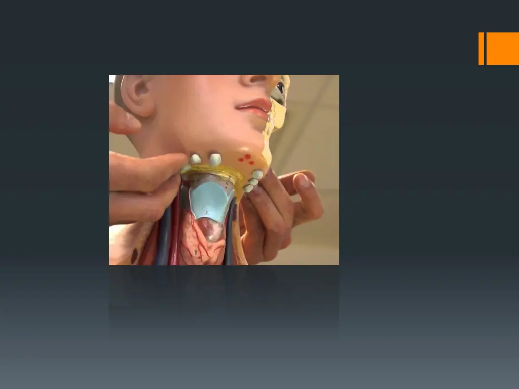 slide16