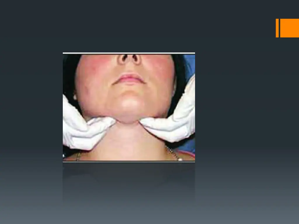 slide17