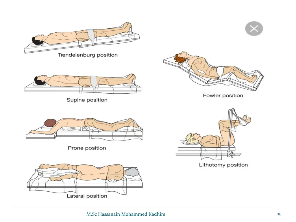slide10