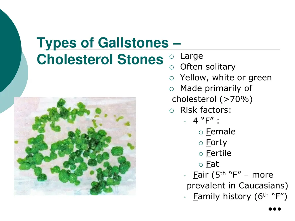 types of gallstones cholesterol stones