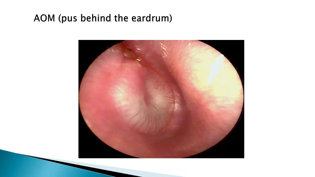 slide11